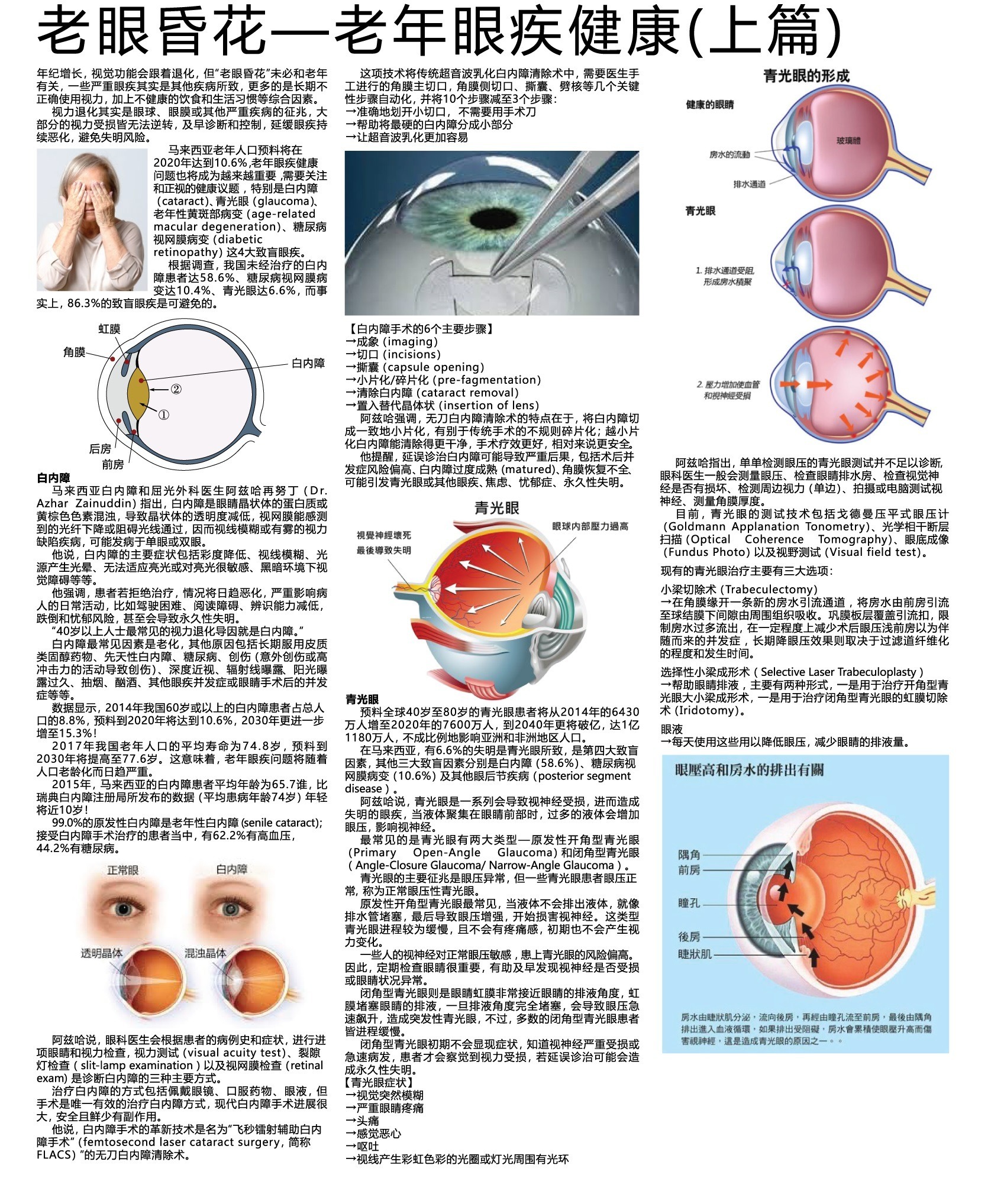 Aging Vision Eye Diseases That Come With Age Part 1 Vista Eye Aging Vision Eye Diseases That Come With Age Part 1 Vista Eye