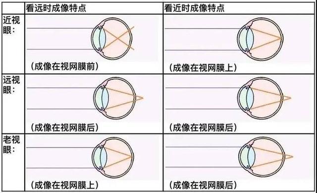 老花与近视和远视有什么区别?